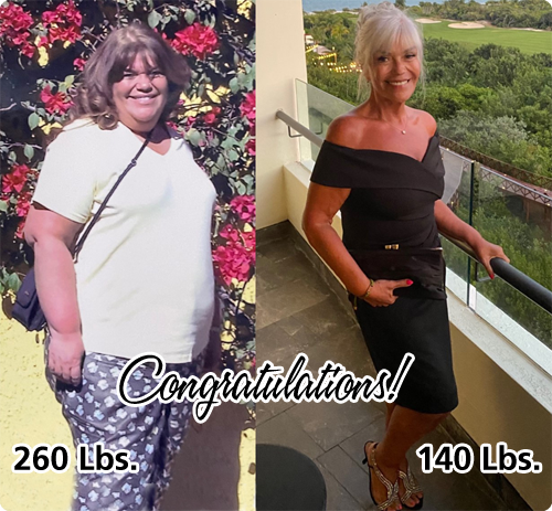 Congratulations! One of our patients lost 120 Lbs.